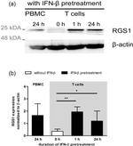 RGS1 Antibody in Western Blot (WB)