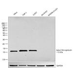 beta-2 Microglobulin Antibody