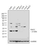 RAC2 Antibody in Western Blot (WB)