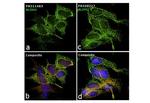 ALDH2 Antibody