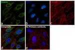 Emerin Antibody in Immunocytochemistry (ICC/IF)