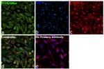 PP2A alpha Antibody in Immunocytochemistry (ICC/IF)