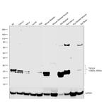 TAGLN Antibody in Western Blot (WB)