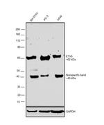 ETV5 Antibody in Western Blot (WB)