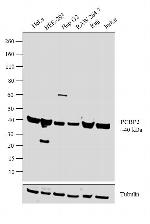 PCBP2 Antibody in Western Blot (WB)