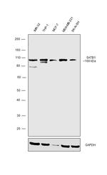 SATB1 Antibody in Western Blot (WB)