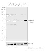 UQCRC2 Antibody