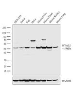 HYAL2 Antibody in Western Blot (WB)