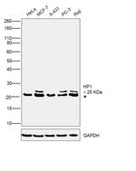 HP1 beta Antibody in Western Blot (WB)