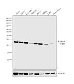 RAB33B Antibody in Western Blot (WB)