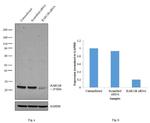 RAB11B Antibody