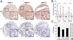 ZC3HAV1 Antibody in Immunohistochemistry (IHC)