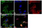 S100A6 Antibody in Immunocytochemistry (ICC/IF)