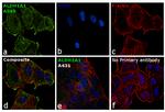 ALDH1A1 Antibody in Immunocytochemistry (ICC/IF)