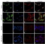 CTGF Antibody