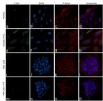 CTGF Antibody in Immunocytochemistry (ICC/IF)