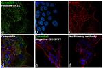 Caveolin 1 Antibody in Immunocytochemistry (ICC/IF)