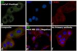 Involucrin Antibody