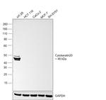 Cytokeratin 20 Antibody