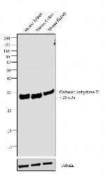 Carbonic Anhydrase II Antibody in Western Blot (WB)