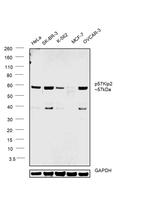 p57 Kip2 Antibody in Western Blot (WB)