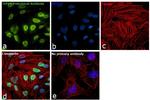 TIP60 Antibody in Immunocytochemistry (ICC/IF)