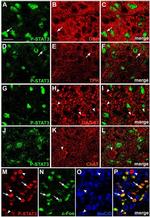 Dopamine beta Hydroxylase Antibody in Immunohistochemistry (IHC)