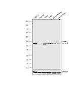 eIF4A1 Antibody in Western Blot (WB)