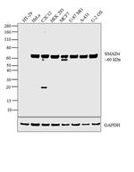 SMAD4 Antibody in Western Blot (WB)