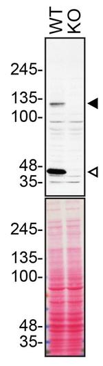 beta Dystroglycan Antibody in Western Blot (WB)