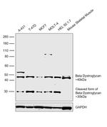 beta Dystroglycan Antibody in Western Blot (WB)