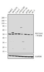 SLC11A2 Antibody in Western Blot (WB)