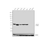 HLA-B Antibody