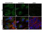 Glutaminase Antibody in Immunocytochemistry (ICC/IF)