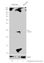 Phospho-Cardiac Troponin I (Ser23, Ser24) Antibody in Western Blot (WB)