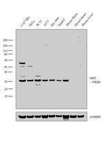 MPZ Antibody in Western Blot (WB)