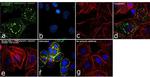 Phospho-ErbB2 (HER-2) (Tyr1221, Tyr1222) Antibody