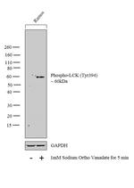 Phospho-LCK (Tyr394) Antibody