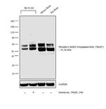 Phospho-CaMKII beta/gamma/delta (Thr287) Antibody