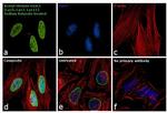 H2A.Zac pan-acetyl (K4,K7,K11) Antibody