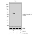 Phospho-CHK1 (Ser317) Antibody in Western Blot (WB)