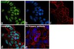 CTCF Antibody in Immunocytochemistry (ICC/IF)