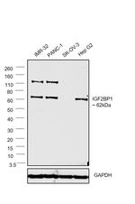 IGF2BP1 Antibody