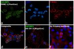 IGF2BP1 Antibody in Immunocytochemistry (ICC/IF)