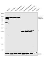 CNTNAP1 Antibody in Western Blot (WB)