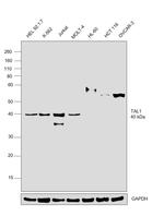 TAL1 Antibody in Western Blot (WB)