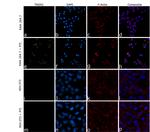 TREM2 Antibody