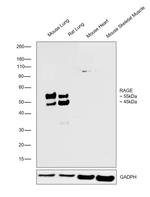 RAGE Antibody