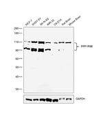 PPP1R9B Antibody in Western Blot (WB)