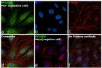 PYCARD Antibody in Immunocytochemistry (ICC/IF)